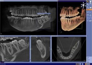3D Scan 2